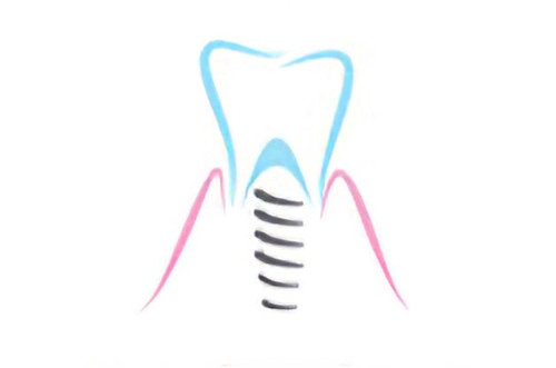 Cabinet dentaire Soumoulou implants dentaires