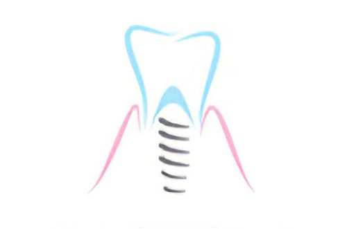 Cabinet dentaire Soumoulou implants dentaires