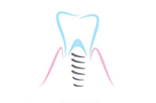 soins dentaires Soumoulou implants dentaires